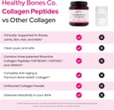 fortibone-collagen-peptides-for-bone-health-joints-skin-hair-nails-hydrolyzed-anti-aging-formula-with-fortigel-verisol-30-servings-02-fortibone-collagen-peptides-for-bone-health-joints-2.jpg
