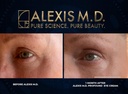 alexis-m-d-profound-c-complex-20-vitamin-c-and-glutathione-serum-30ml-bottle-02-alexis-md-profound-c-complex---20-vitamin-c-and-gl-2.jpg